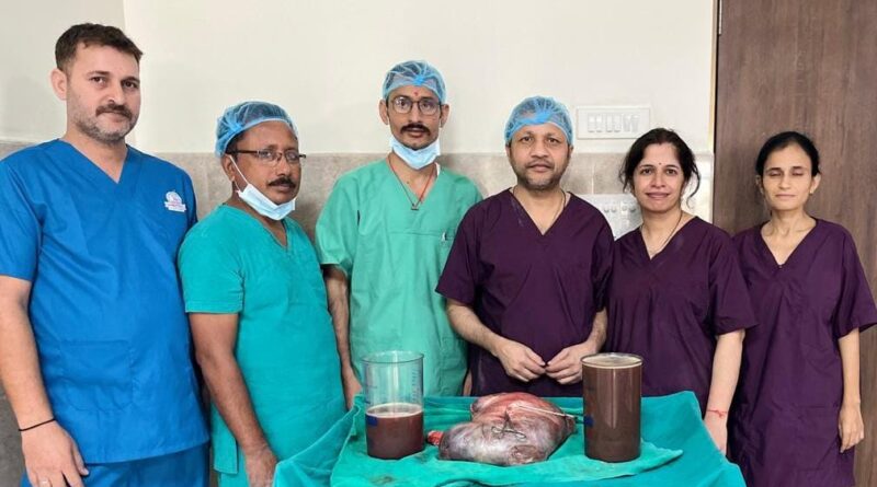 श्री सिद्धिविनायक हॉस्पिटल में 60 वर्षीय महिला के पेट से निकाली 12 किलो की रसौली…शरद